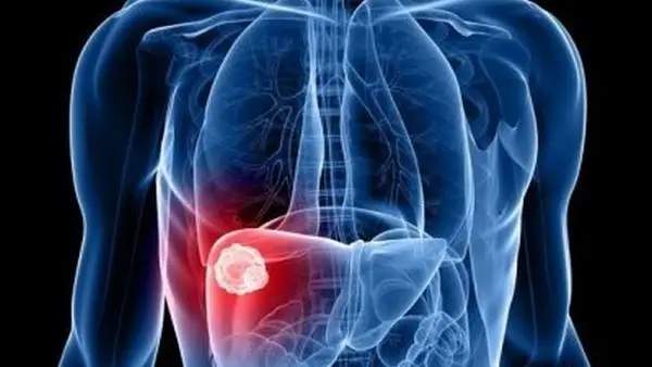 Вирусные гепатиты в Кыргызстане: диагностика, лечение и вакцинация