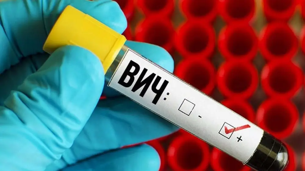 В Кыргызстане зарегистрировано 12 тыс. 779 случаев ВИЧ-инфекции
