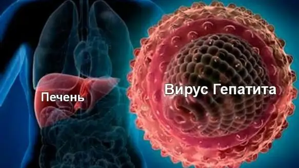 В Кыргызстане медики выявляют все больше больных с вирусными гепатитами